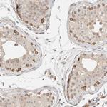 INTS1 Antibody in Immunohistochemistry (Paraffin) (IHC (P))