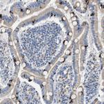 AOAH Antibody in Immunohistochemistry (Paraffin) (IHC (P))