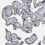 AOAH Antibody in Immunohistochemistry (Paraffin) (IHC (P))