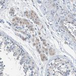 AOAH Antibody in Immunohistochemistry (Paraffin) (IHC (P))