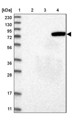 AOAH Antibody in Western Blot (WB)