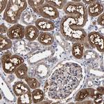 ANKRD40 Antibody in Immunohistochemistry (Paraffin) (IHC (P))