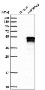 ANKRD40 Antibody in Western Blot (WB)