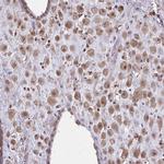 NRBF2 Polyclonal Antibody