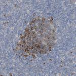 UBAP2 Antibody in Immunohistochemistry (Paraffin) (IHC (P))