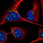 ANKRD40 Antibody in Immunocytochemistry (ICC/IF)