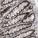 ANKRD40 Antibody in Immunohistochemistry (Paraffin) (IHC (P))