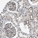 RBM33 Antibody in Immunohistochemistry (Paraffin) (IHC (P))