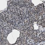 RBM33 Antibody in Immunohistochemistry (Paraffin) (IHC (P))