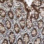 RBM33 Antibody in Immunohistochemistry (IHC)