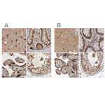 CBLL1 Polyclonal Antibody