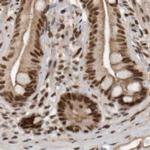 CBLL1 Antibody in Immunohistochemistry (IHC)