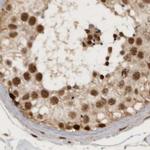 CBLL1 Antibody in Immunohistochemistry (IHC)