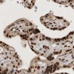 CBLL1 Antibody in Immunohistochemistry (IHC)