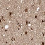 CBLL1 Antibody in Immunohistochemistry (IHC)