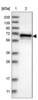 CBLL1 Antibody in Western Blot (WB)