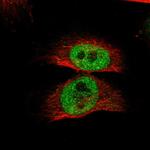 RBM48 Polyclonal Antibody