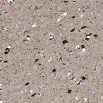 RBM48 Antibody in Immunohistochemistry (IHC)