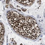 ANKIB1 Antibody in Immunohistochemistry (Paraffin) (IHC (P))