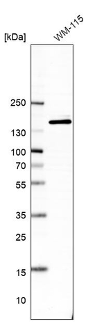 ANKIB1 Antibody in Western Blot (WB)