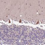 DENR Antibody in Immunohistochemistry (Paraffin) (IHC (P))
