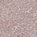 DENR Antibody in Immunohistochemistry (Paraffin) (IHC (P))