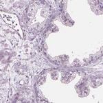 C9orf117 Antibody in Immunohistochemistry (IHC)