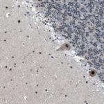 CENPP Polyclonal Antibody