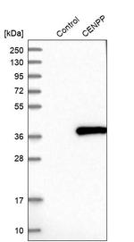 CENPP Antibody in Western Blot (WB)