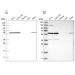 PRPF4 Antibody in Western Blot (WB)