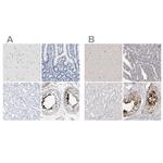 Actin-like 7B Polyclonal Antibody