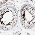 Actin-like 7B Antibody in Immunohistochemistry (IHC)