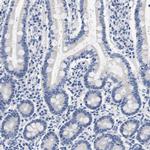 Actin-like 7B Antibody in Immunohistochemistry (IHC)