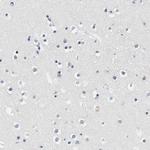 Actin-like 7B Antibody in Immunohistochemistry (IHC)