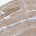 MYH3 Antibody in Immunohistochemistry (IHC)