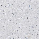 MYH3 Antibody in Immunohistochemistry (IHC)
