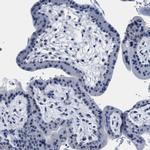 MYH3 Antibody in Immunohistochemistry (IHC)