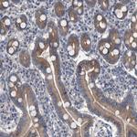 MAMDC2 Antibody in Immunohistochemistry (Paraffin) (IHC (P))