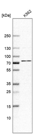 ABCF2 Antibody in Western Blot (WB)