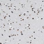 NUP88 Antibody in Immunohistochemistry (Paraffin) (IHC (P))