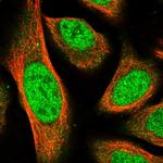 MPP3 Polyclonal Antibody