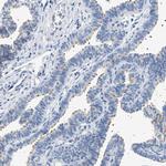 NAT9 Antibody in Immunohistochemistry (Paraffin) (IHC (P))