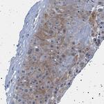 NAT9 Polyclonal Antibody