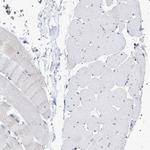NAT9 Antibody in Immunohistochemistry (Paraffin) (IHC (P))