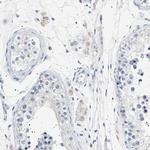 NAT9 Antibody in Immunohistochemistry (Paraffin) (IHC (P))