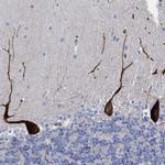 HS3ST5 Antibody in Immunohistochemistry (Paraffin) (IHC (P))