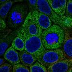 HSD17B2 Polyclonal Antibody