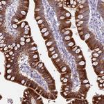HSD17B2 Antibody in Immunohistochemistry (IHC)