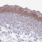 HSD17B2 Antibody in Immunohistochemistry (IHC)