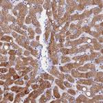 HSD17B2 Antibody in Immunohistochemistry (IHC)
